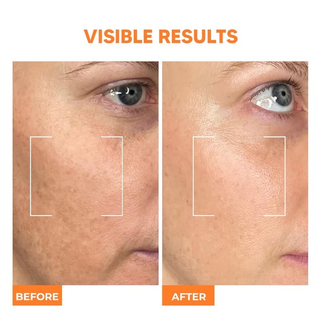 VITAMIN-C-SETSLAJD-3---ENG_1