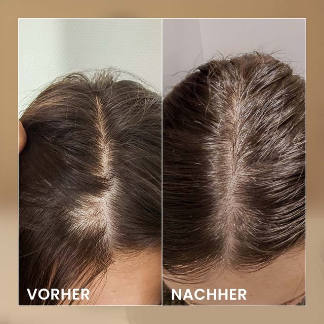 BIOELIXIR-SCALP----prije-posle---DE